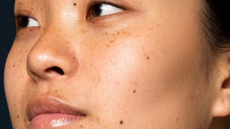 Korean skincare for oily skin