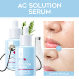  AC Solution serum - Korean-Skincare