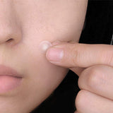Pyunkang Yul ACNE Spot Patch Super Thin - Korean-Skincare